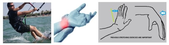 5-Handgelenksverletzung