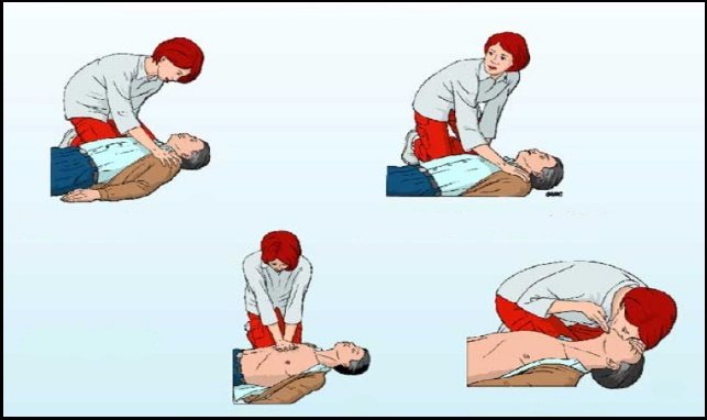 6-thức-và-cách-thực-hiện-CPR