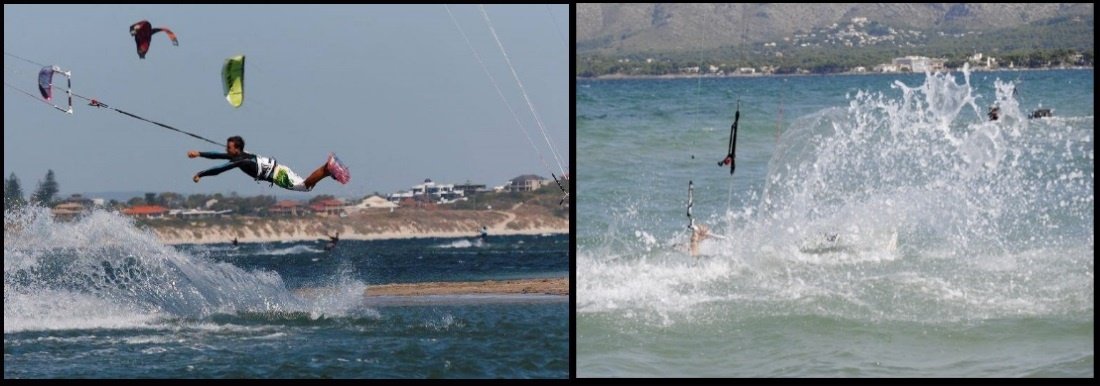 1 kitesurfing injuries after a wipeout